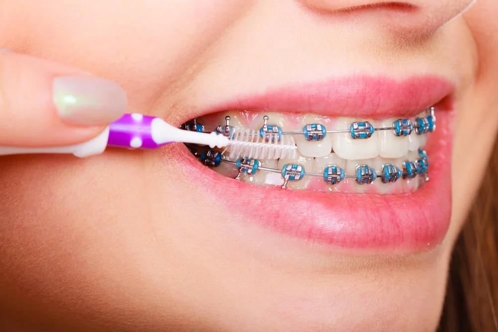 How Technology Is Transforming Orthodontic Care