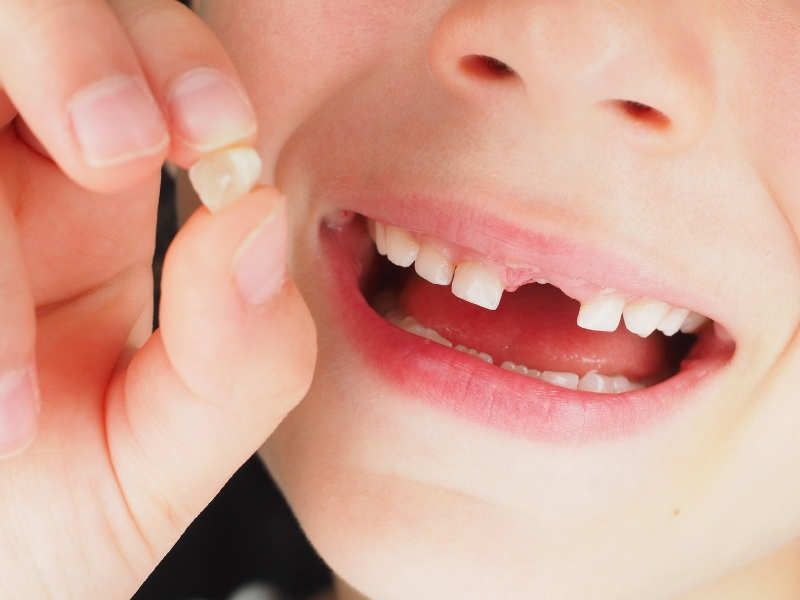 Early Signs of Tooth Decay in Children