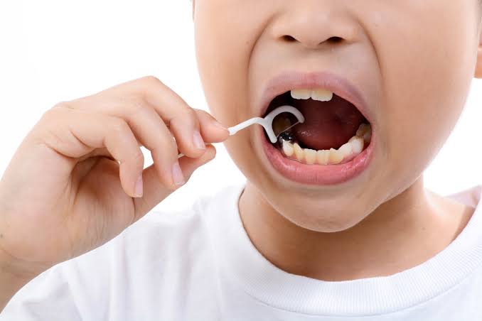 Why Flossing Is Important for Children